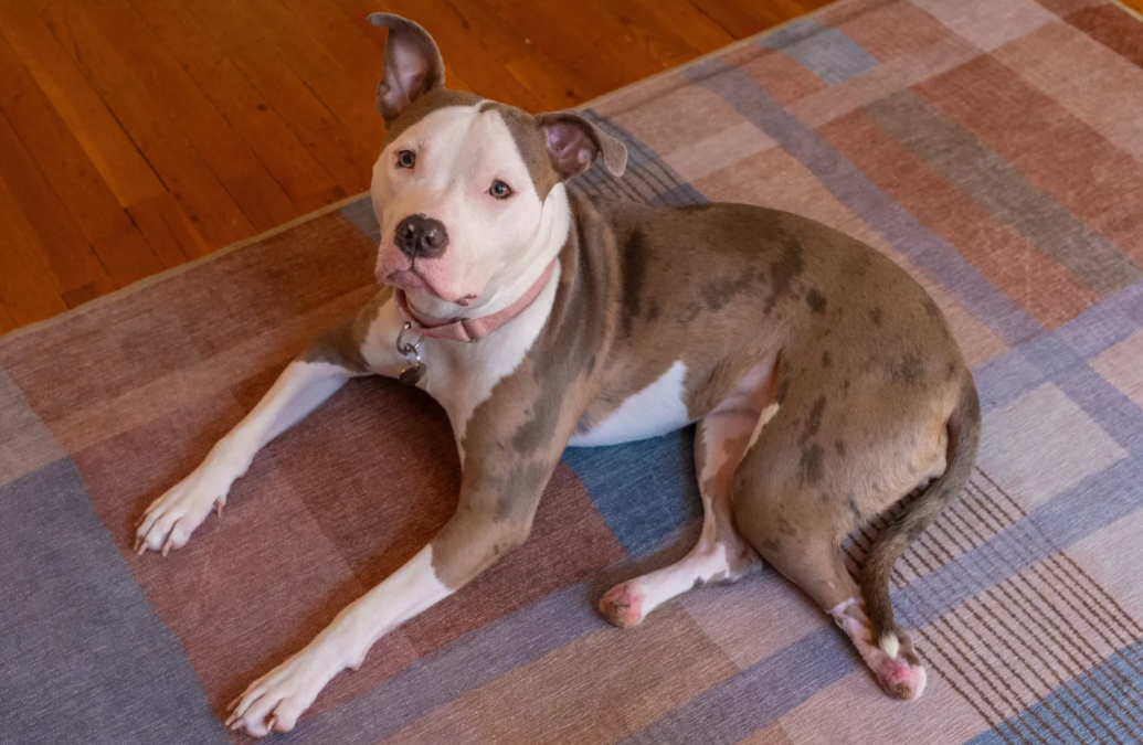 Her First Prosthetic Leg Changed Everything